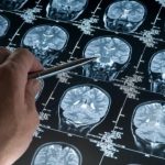 brain-scan