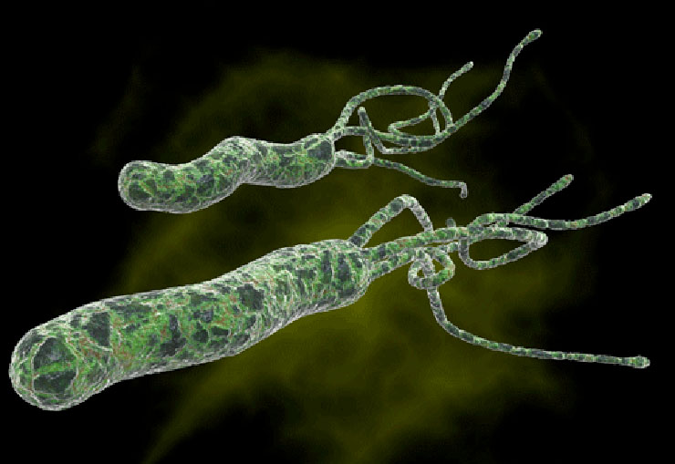 Best Natural Treatment For Helicobacter Pylori Best Natural Treatment For Helicobacter Pylori