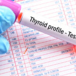 thyroid-tests