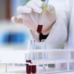 vitamin-d-levels