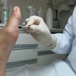 diabetic-neuropathy