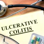 ulcerative-colitis