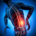 chronic-low-back-pain