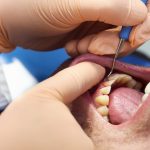 gum-disease-linked-to-mental-illness