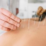 acupuncture-enhances-health