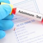 autoimmune-diseases-triggered