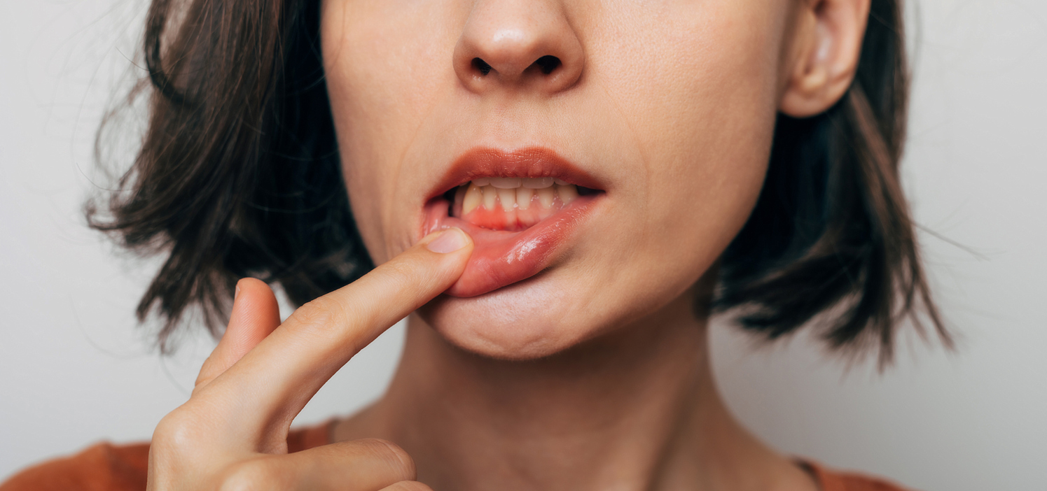 Gum Disease Linked To Changes In Brain Cells | NaturalHealth365