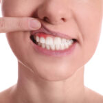 gum-disease-linked-to-cancer