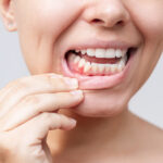 gum-disease