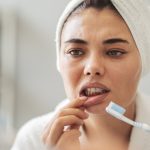 oral-infections