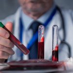 blood-tests