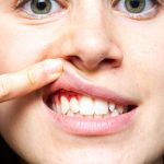 The largest gum disease study ever conducted just exposed what dentistry got completely wrong